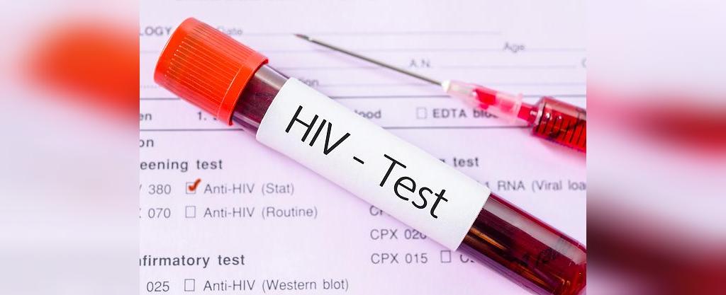 تشخیص اچ آی وی 