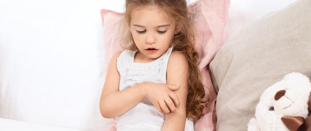 علائم و نشانه های اگزما در کودکان