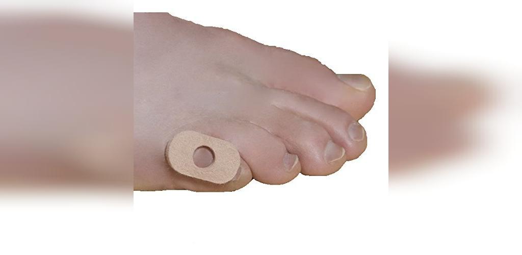 درمان میخچه پا با استفاده از پد میخچه