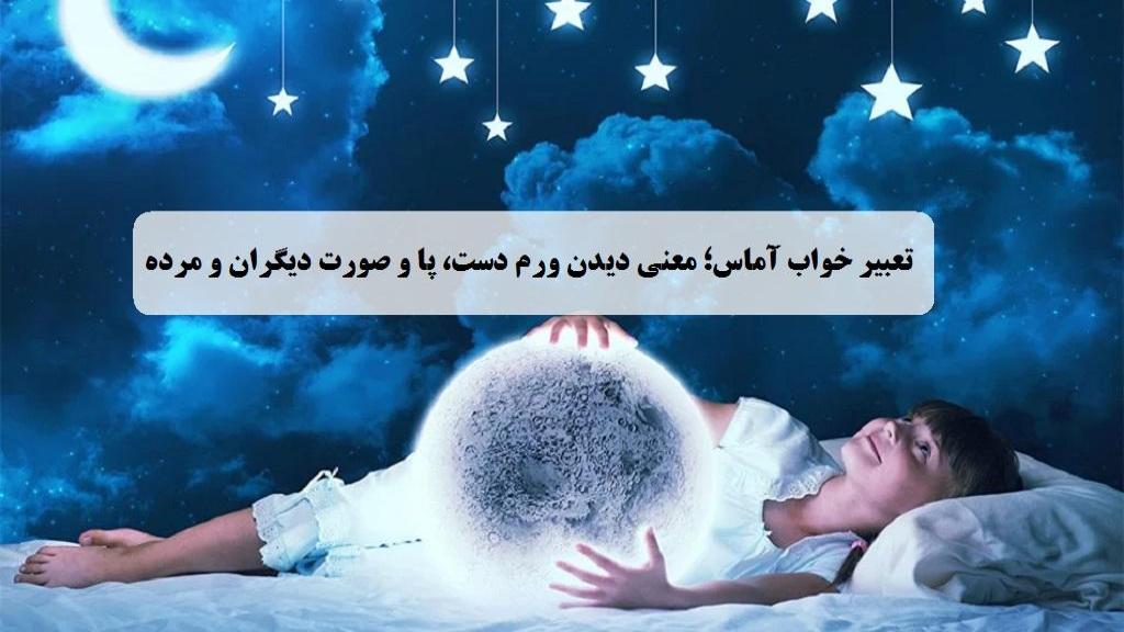 تعبیر خواب آماس؛ معنی دیدن ورم دست، پا و صورت دیگران و مرده امام صادق