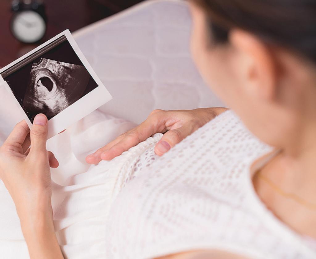 عکس جنین در هفته چهاردهم بارداری