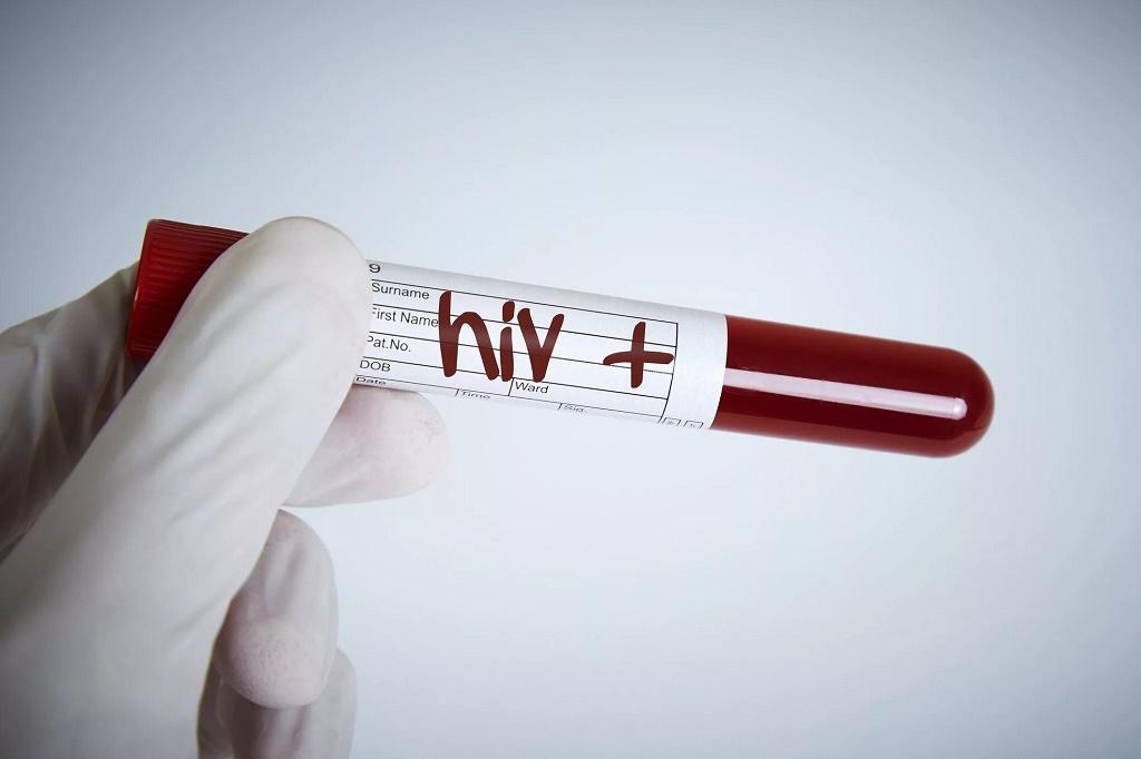   HIVعوامل خطر ساز سندرم استیون جانسون - عفونت