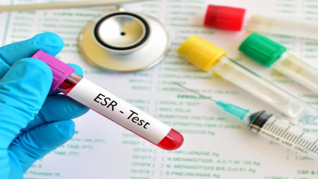 آزمایش ESR؛ بالا یا پایین بودن تست ای اس آر در آزمایش خون بیان کننده چیست؟