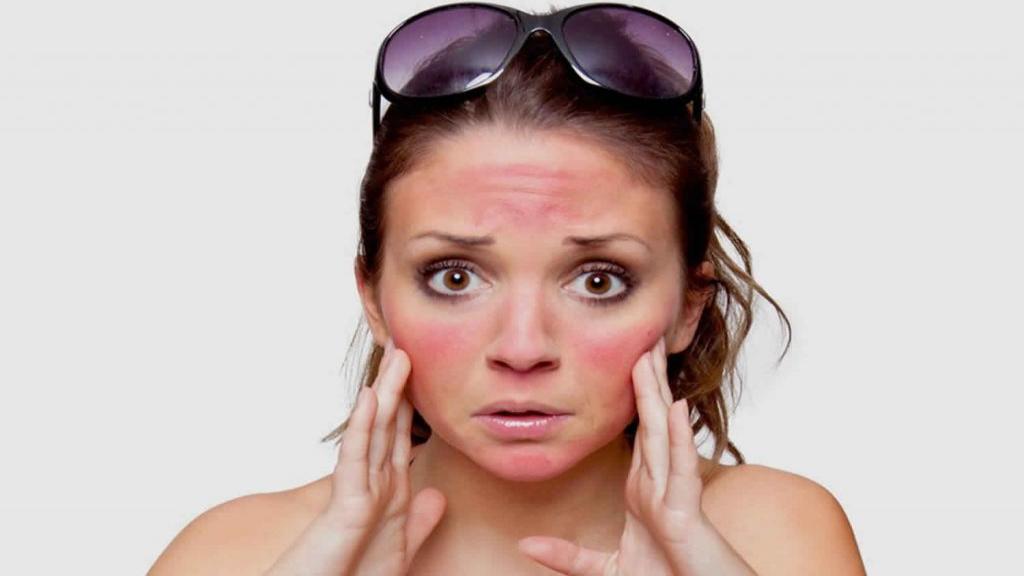 10 اشتباه رایج که انجام آنها آفتاب سوختگی را وخیم تر می کند
