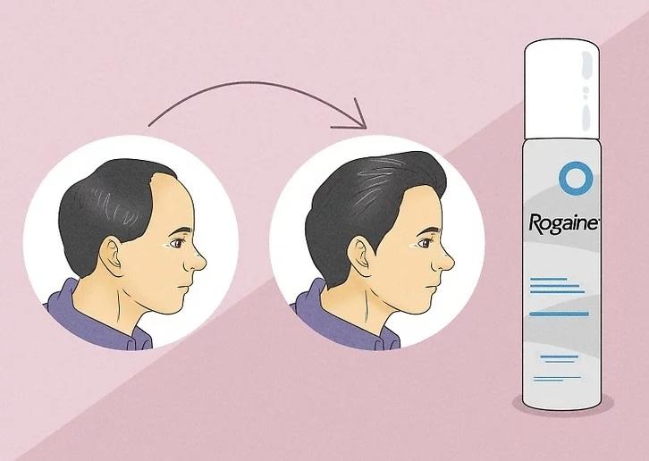 چگونه از ریزش مو جلوگیری کنیم؟ 10