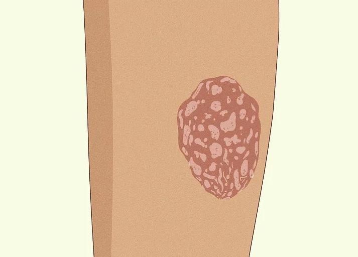 علت شایع خارش پاها  8