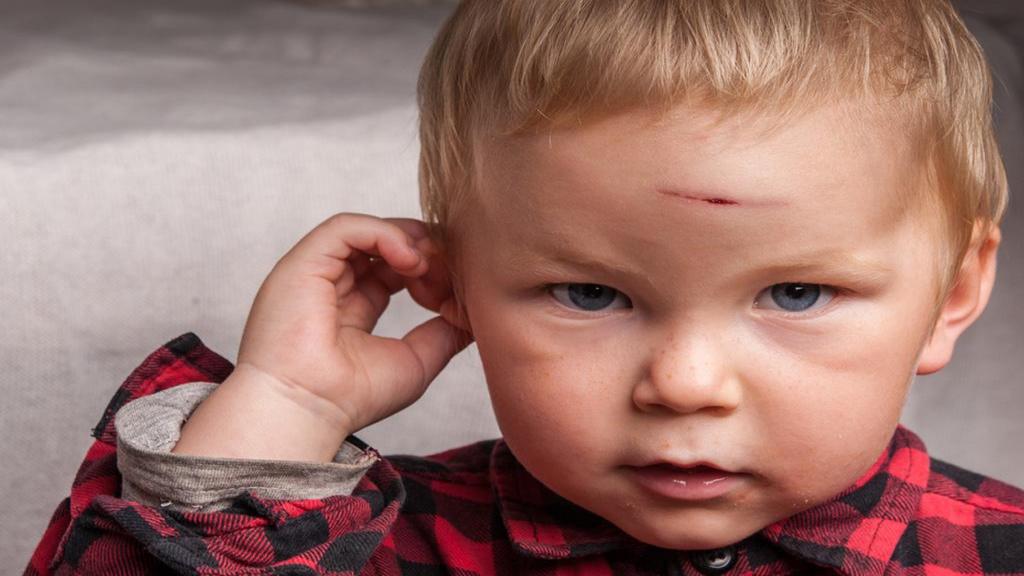 دلایلی که کودک نوپا سرش را عمدا به جایی می کوبد و روش های درمان آن