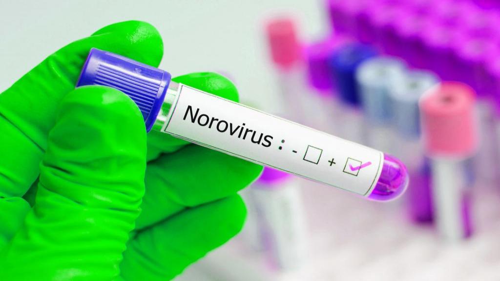 علت عفونت نورو ویروس چیست؛ علائم و درمان عفونت نورو ویروس در خانه