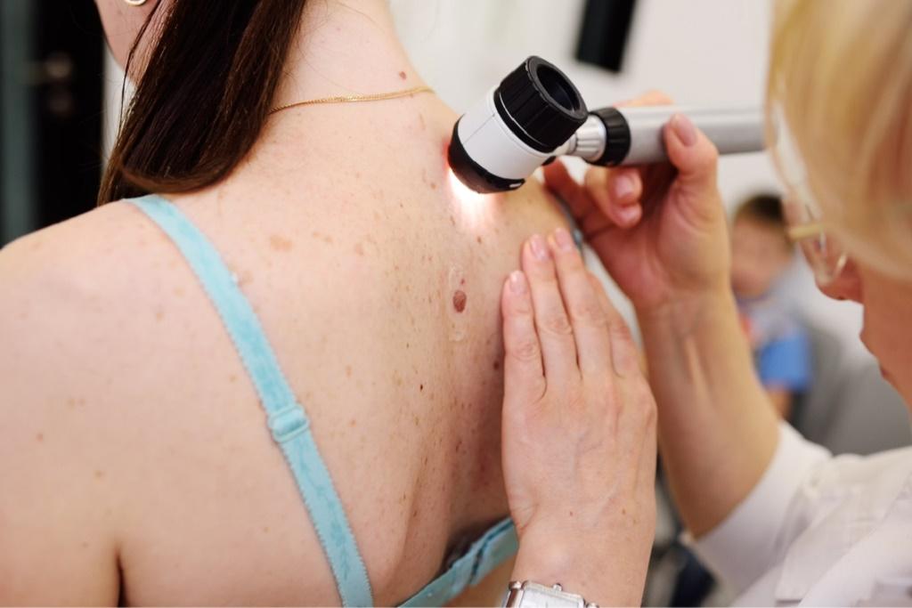 آزمایش های ضروری برای خانم های 40 ساله: آزمایش های پوستی