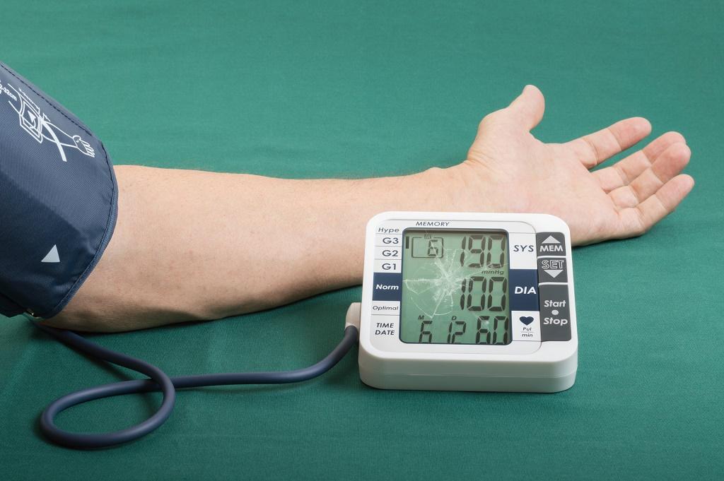 فشار خون بالای کنترل نشده- عوامل مرتبط با سکته هموراژیک