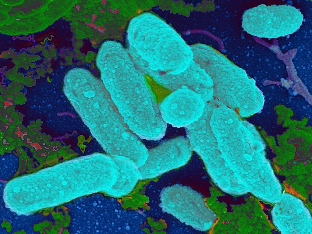 شایع ترین باکتری هایی که باعث سینوزیت حاد می شوند