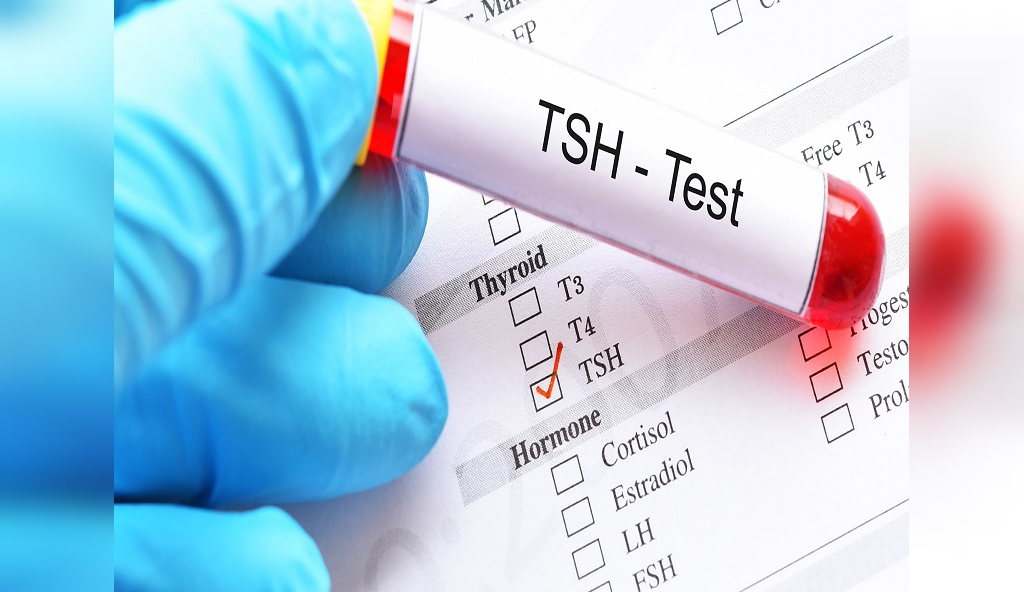  آزمایش های T4 و THS برای تشخیص تیروئید