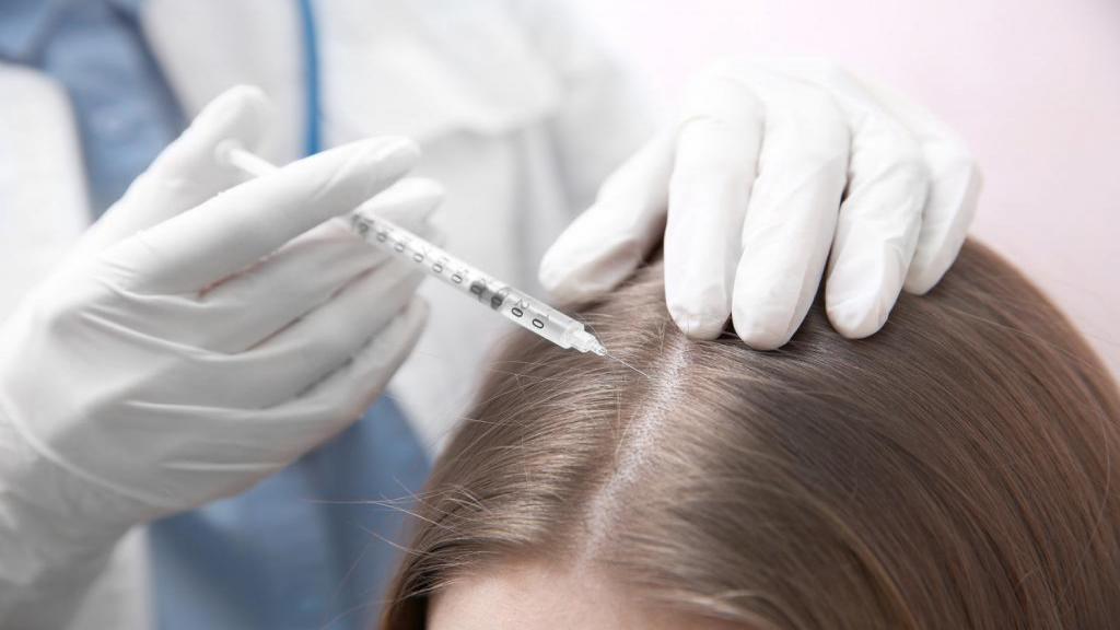 فواید مزوتراپی مو چیست ؛ عوارض و روش انجام مزوتراپی برای ریزش مو