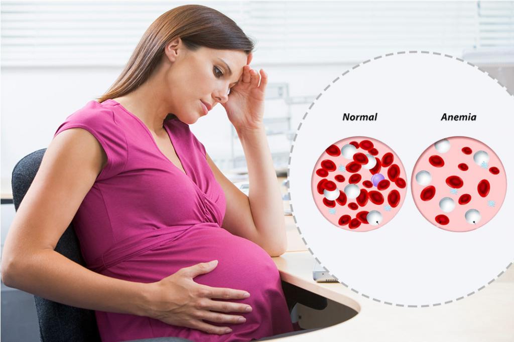 عوامل سرگیجه دوران بارداری