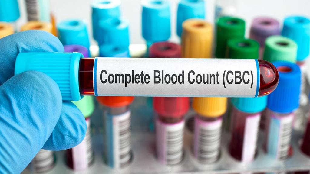 نظارت و آزمایش - آزمایش های خون دوره ای 