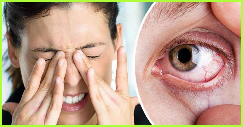 دلایل سندرم خشکی چشم