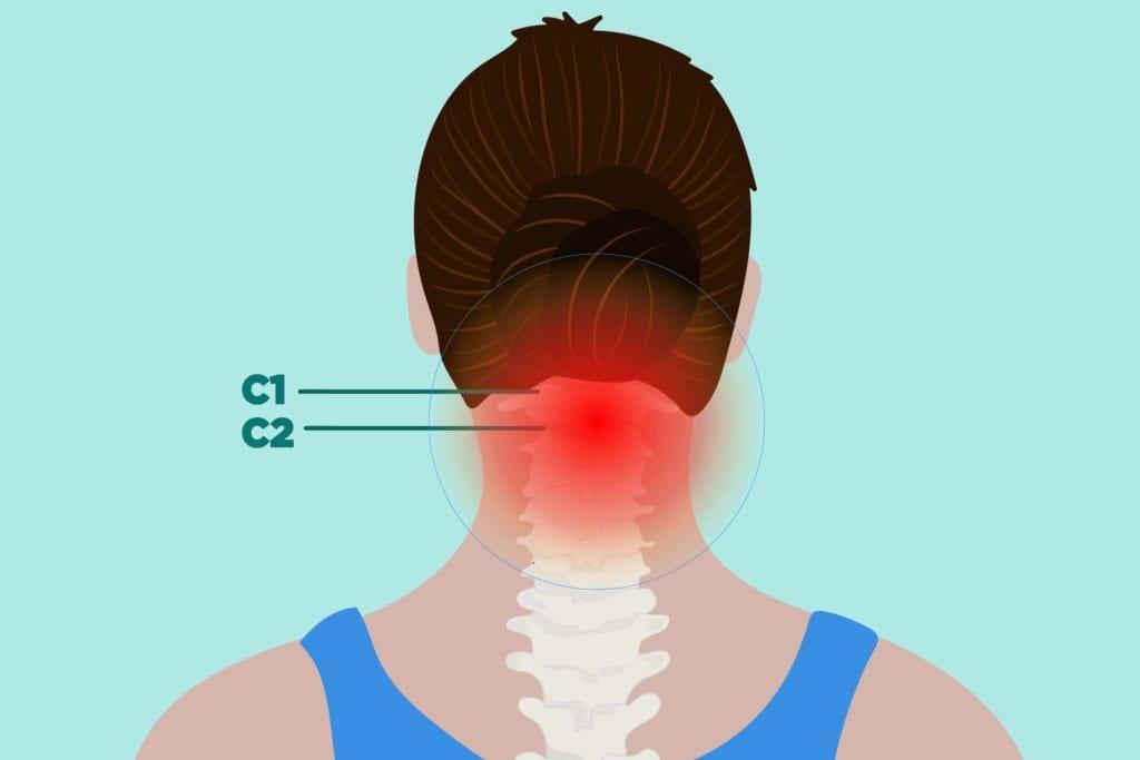 چگونه آرتریت روماتوئید (RA) بر گردن تاثیر می گذارد