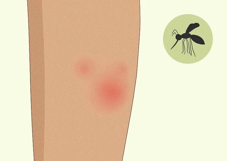 علت شایع خارش پاها  2