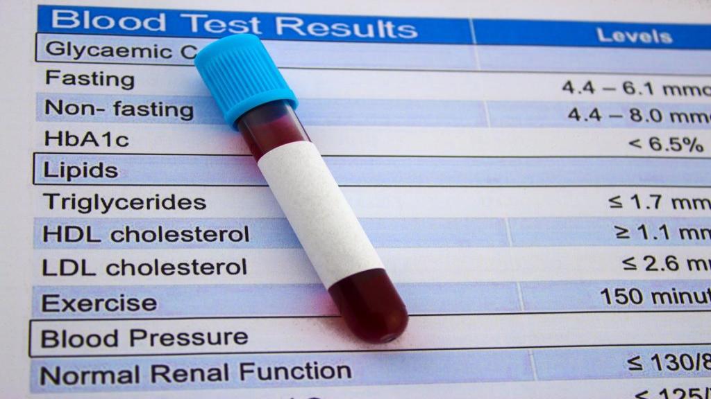 آزمایش LDL چیست؛ علت بالا و پایین بودن ldl در آزمایش خون