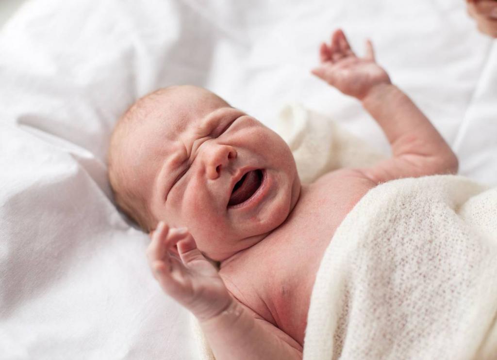 علائم کم کاری تیروئید بدو تولد در نوزادان