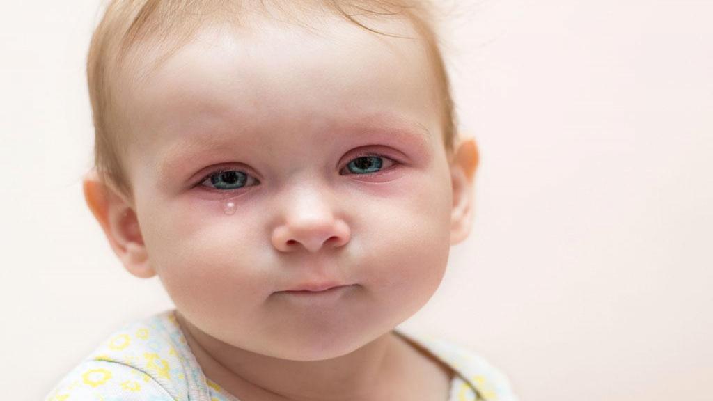 عفونت چشم در نوزادان؛ انواع، علائم، علل و راه های درمان این عفونت ها