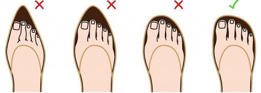 استراتژی های خود مراقبتی انحراف شست پا:پوشیدن کفش مناسب