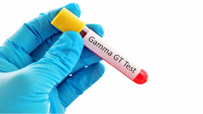 آزمایش GGT چیست؟ + کاربرد ها، نحوه انجام آزمایش و عوارض جانبی آن