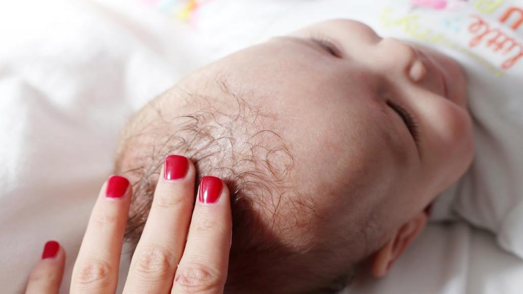 شوره سر در نوزادان: علل، علائم، دارو و درمان های خانگی و روش پیشگیری از آن
