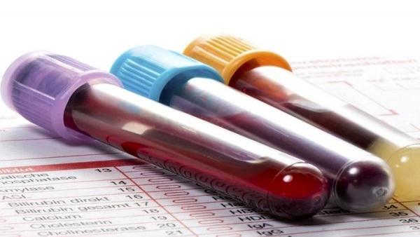 همه چیز درباره تست توزیع گلبول قرمز خون یا آزمایش RDW