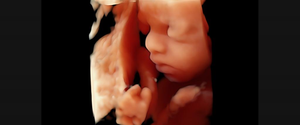 اختلالات جنین که با سونوگرافی مشخص می شود