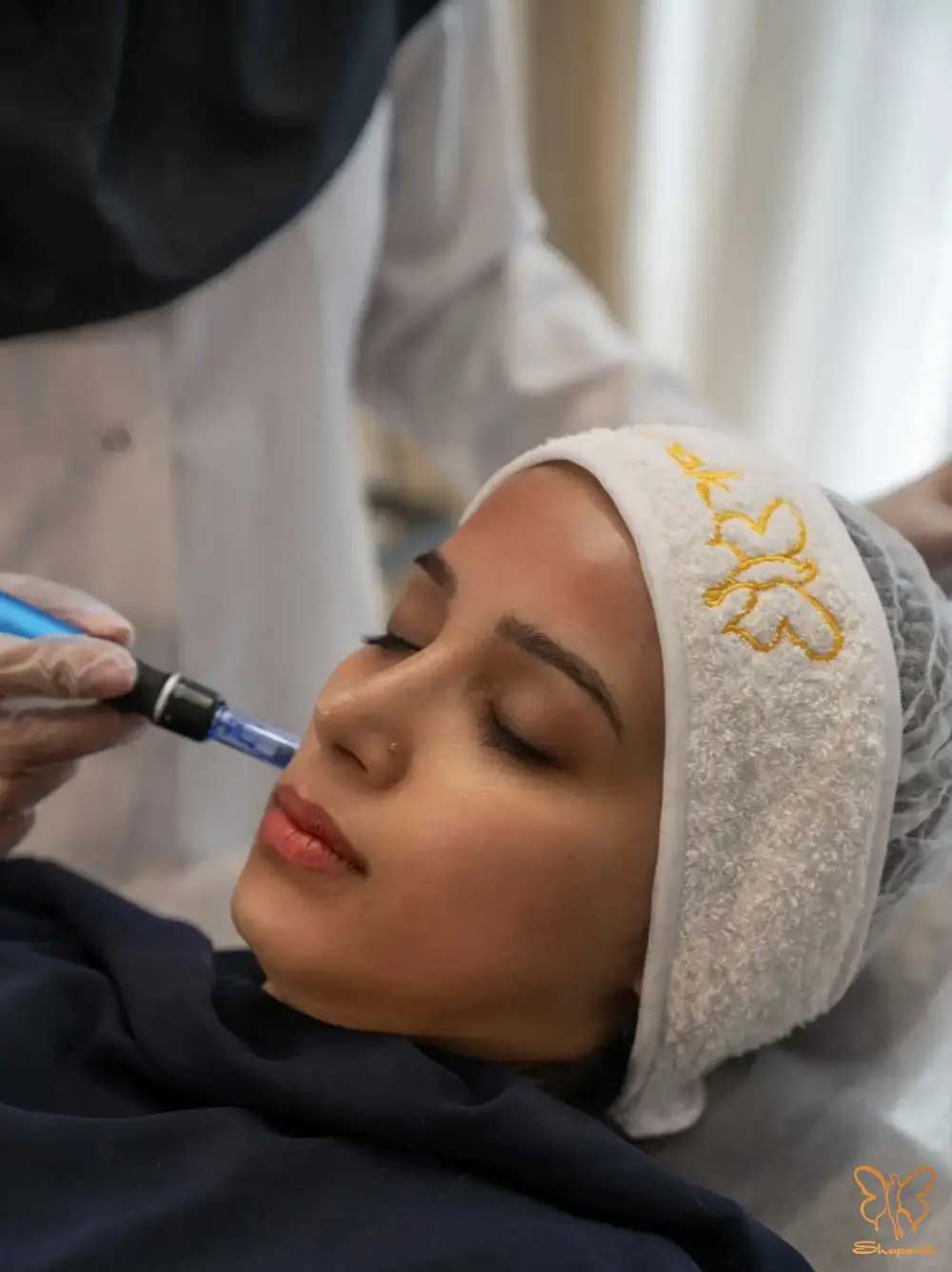 راهنمای کامل مزونیدلینگ سر و صوررت در بهترین کلینیک پوست و مو مشهد