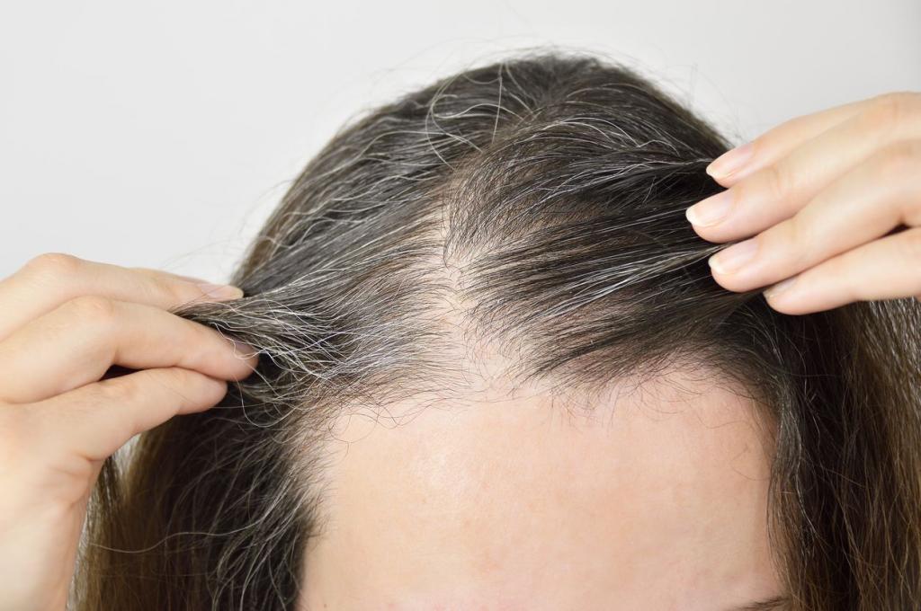 چه عواملی باعث سفید شدن مو در سنین جوانی می شوند؟