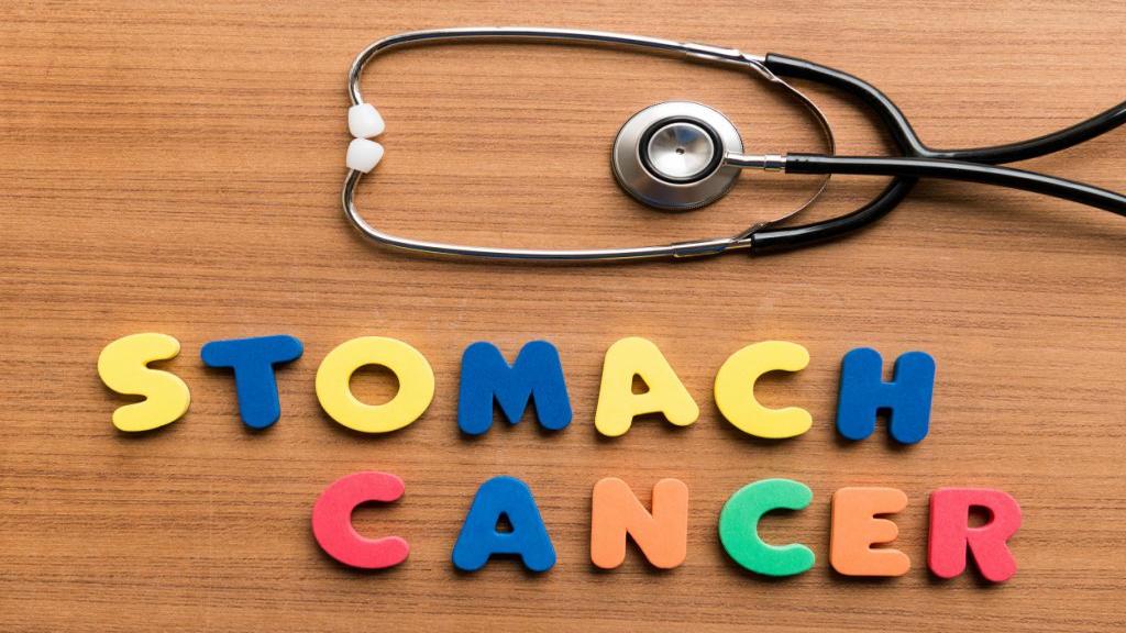 درمان سرطان معده با طب سنتی، گیاهی و پزشکی و هزینه درمان سرطان معده