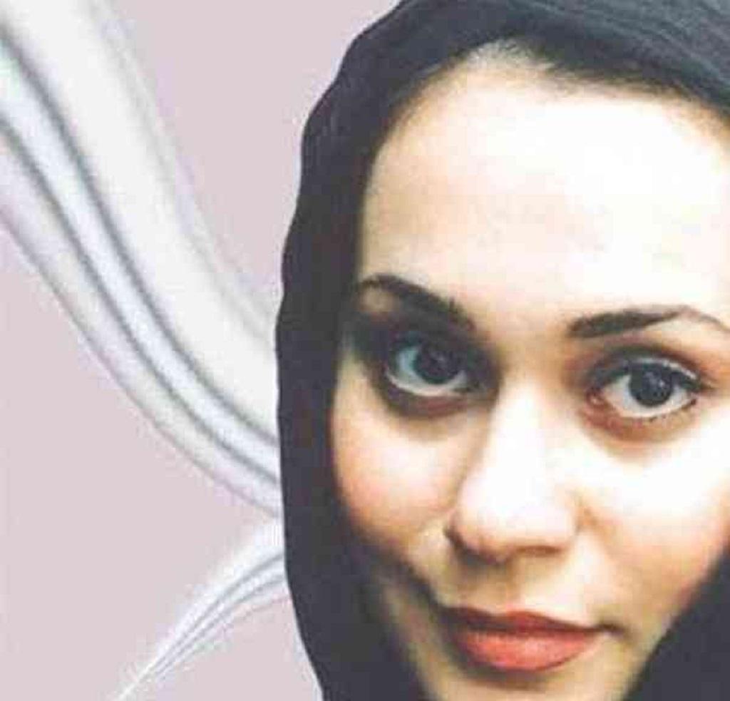 آرام جعفری قبل از عمل 2