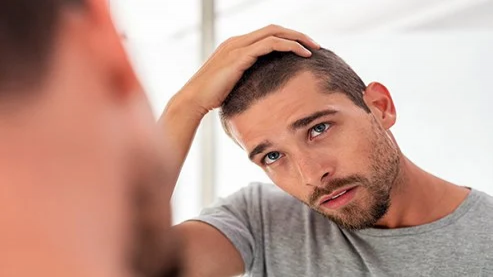 عوارض مصرف قند روی مو؛ رابطه بین ریزش مو مردانه و نوشیدنی های شیرین
