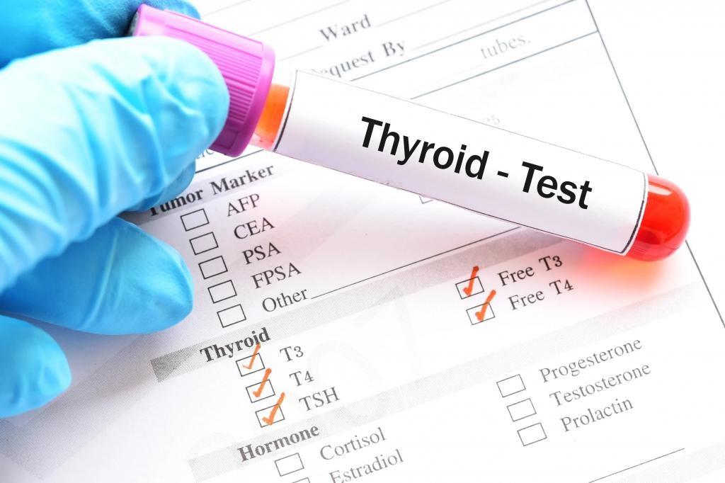 موارد لازم جهت انجام آزمایش تیروئید