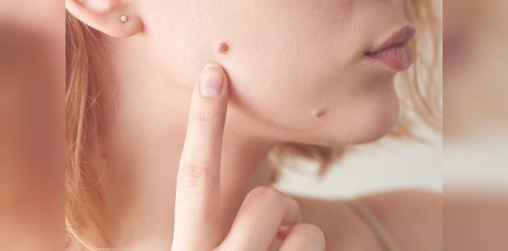 توصیه متخصصان پوست برای جلوگیری از مشکلات پوست