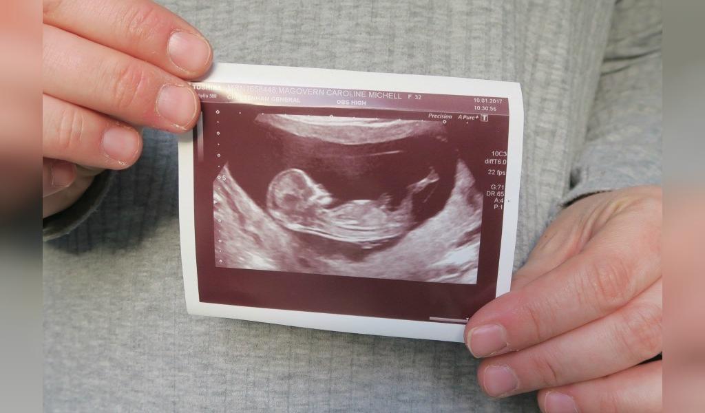 19 неделя 2023. 13 Недель беременности фото. Беременность 6-7 недель фото.