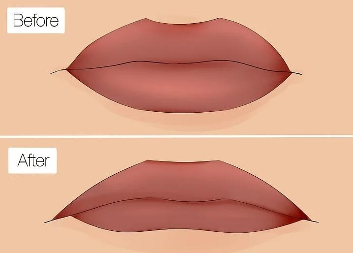 انواع فرم لب 18