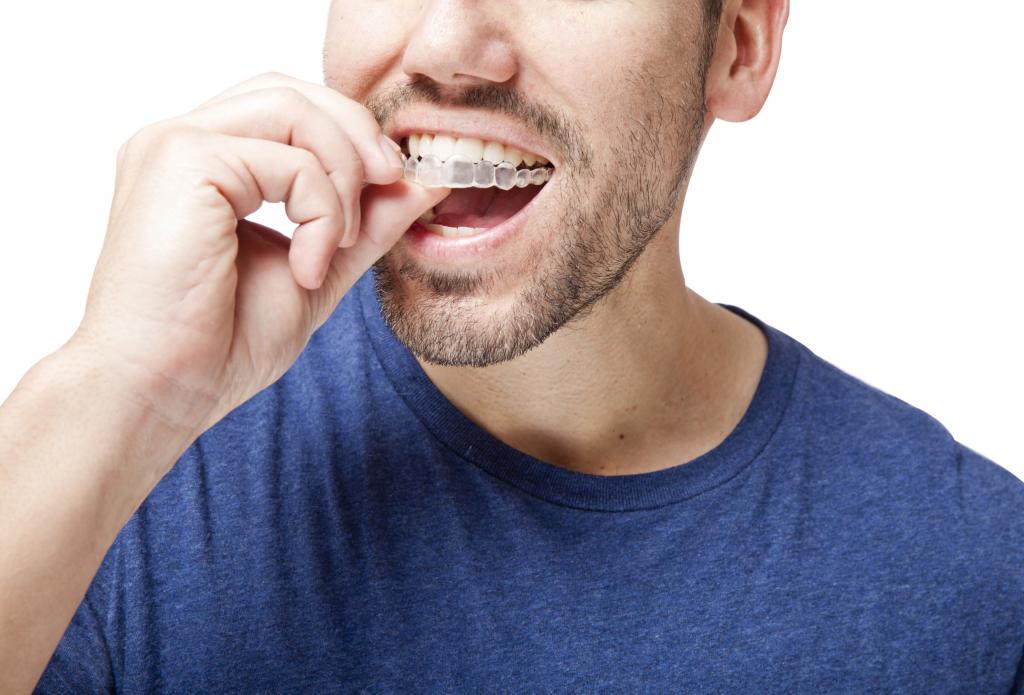 درمان فوری خارش لثه:گارد دهان