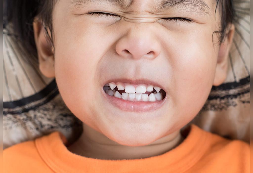 دندان قروچه  یا بروکسیم چیست و علل آن