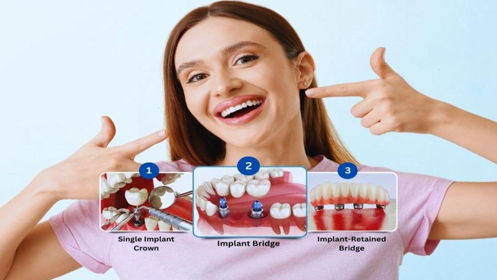 آیا ایمپلنت دندان درد دارد؟ راهنمای جامع، صادقانه و کاربردی برای قبل و بعد از عمل