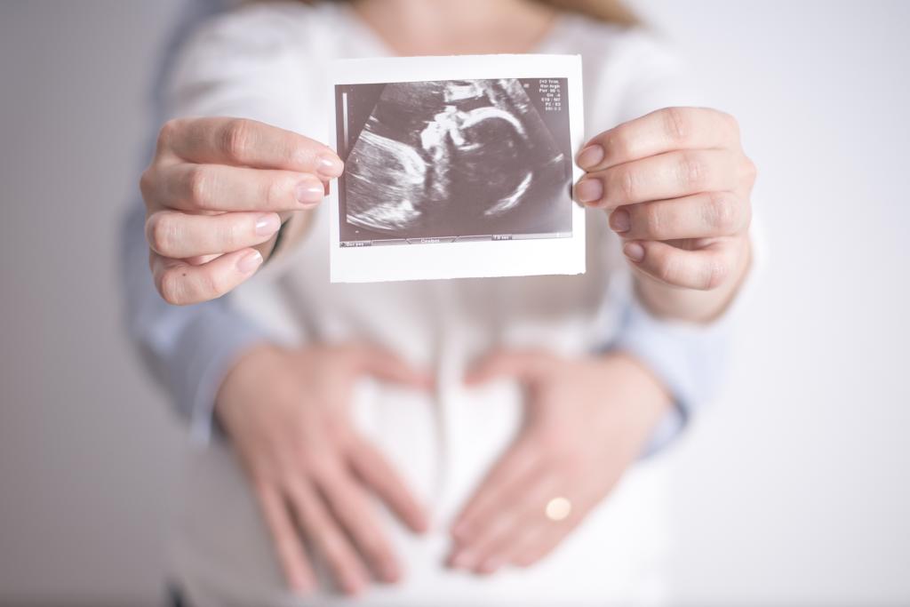 سونوگرافی هفته بیست و نهم بارداری