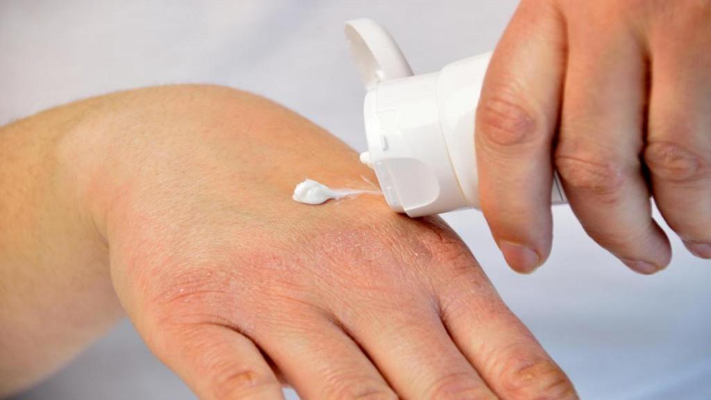 خشکی پوست دست نشانه چیست؛ درمان خانگی خشکی و ترک خوردن پوست دست