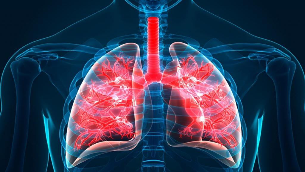 فیبروز ریه چیست + علائم، تشخیص و درمان فیبروز ریوی (fibrosis)