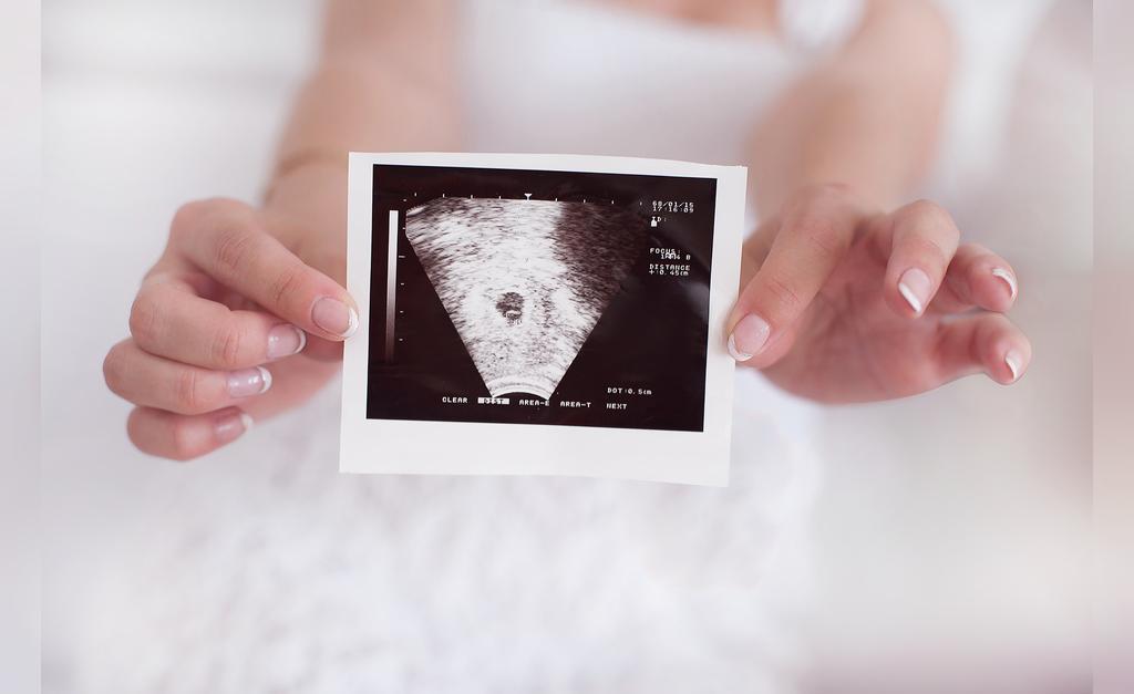 سونوگرافی در هفته هشتم بارداری
