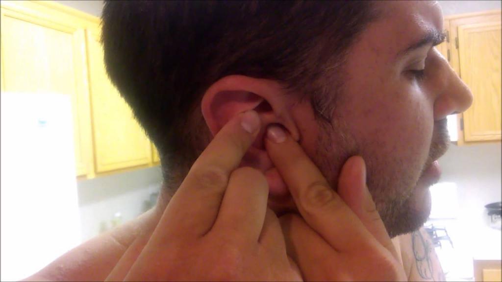 آیا باید جوش های ناحیه لاله گوش را تخلیه کنید؟
