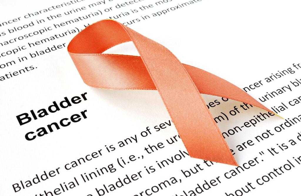سرطان مثانه و هر آنچه درباره آن باید بدانید