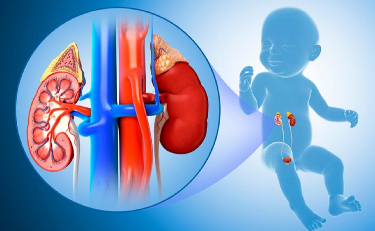 عوارض بلندمدت اکستروفی مثانه