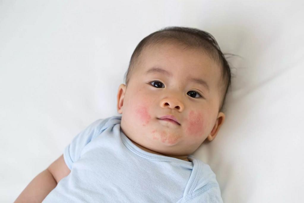 علائم و نشانه های دشواری تنفس در نوزادان